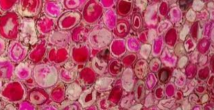 Pink Agate Semi-Precious Stone 2CM